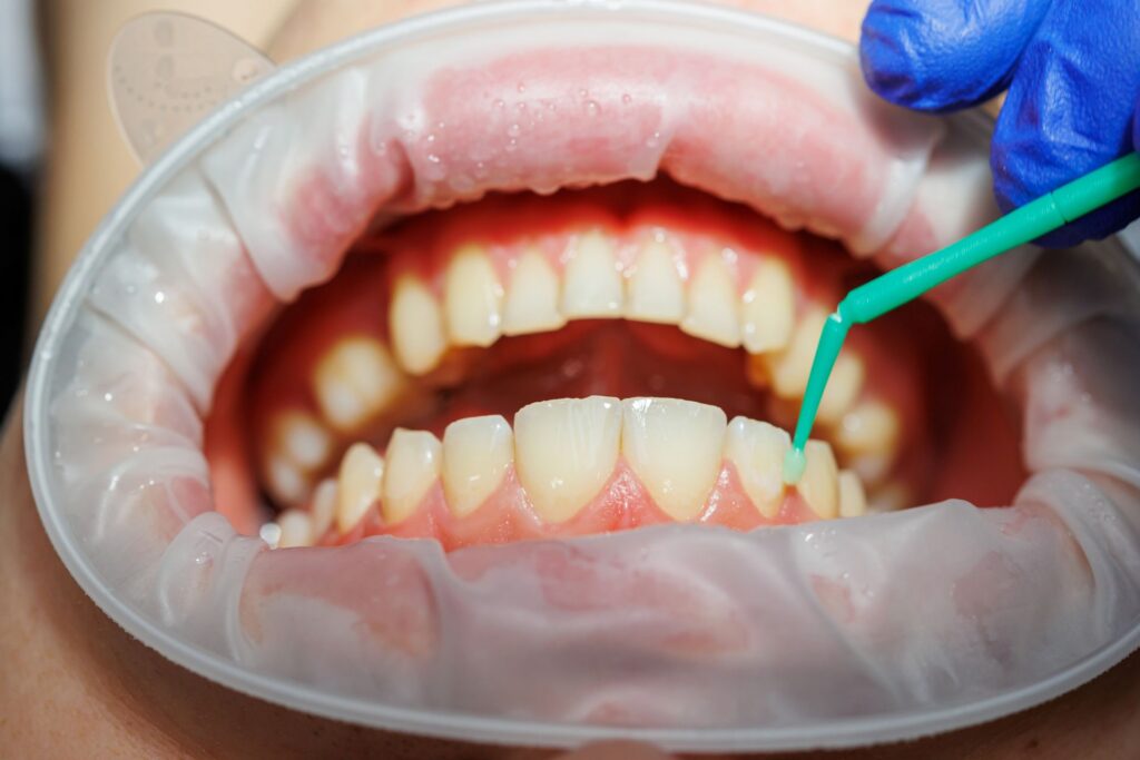 Dentist in Valdosta GA performing comprehensive oral exam with dental mirror.