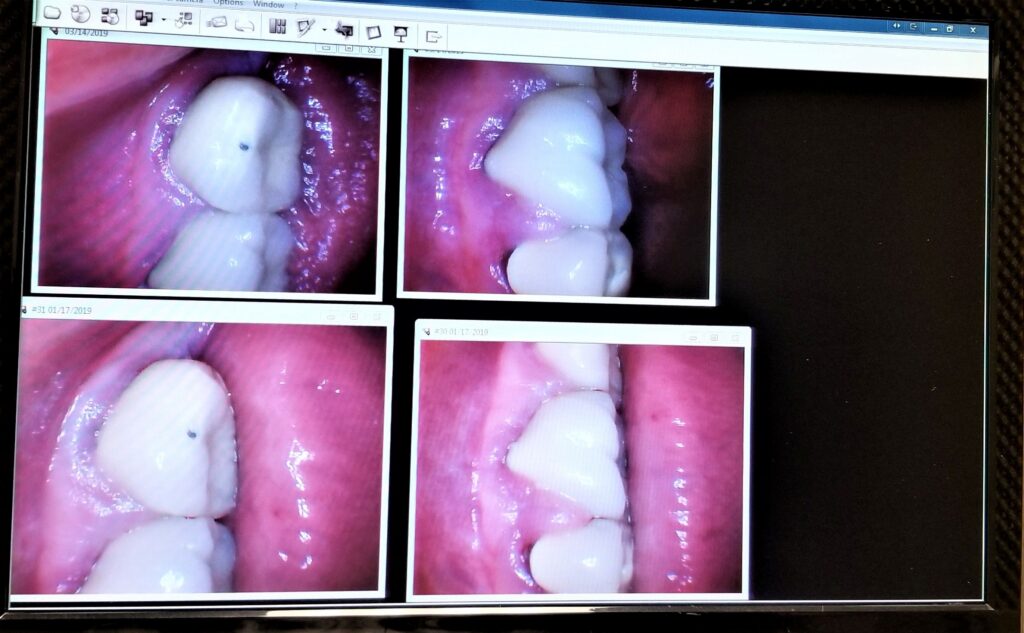 Digital dental imaging and intraoral scan at Valdosta dental office.