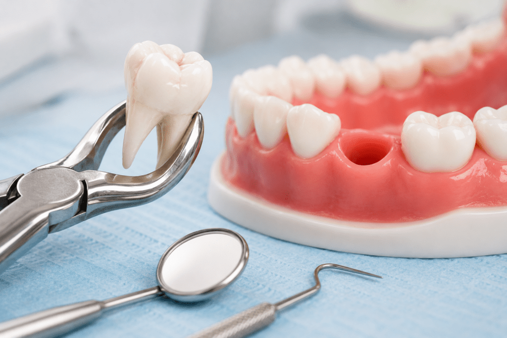 Clean clinical image of a tooth extraction model with dental instruments and an extracted tooth.